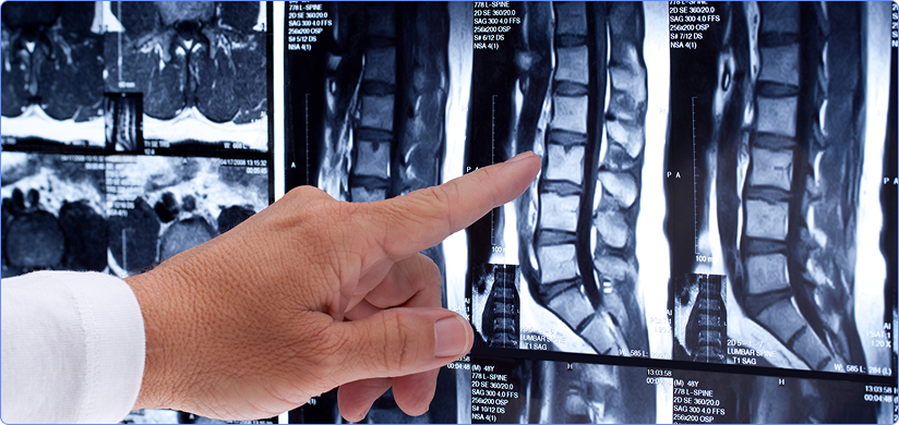 Spine CT Scan Reporting