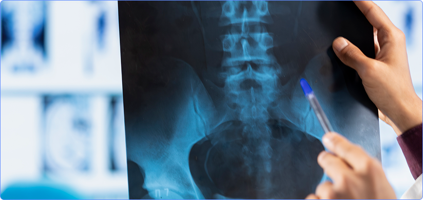 X-ray Preliminary Reads