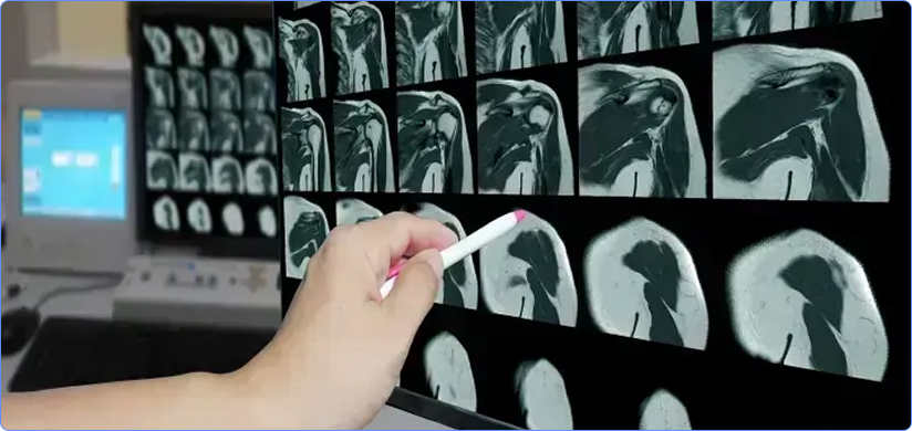 Musculoskeletal (MSK) Radiology Reporting