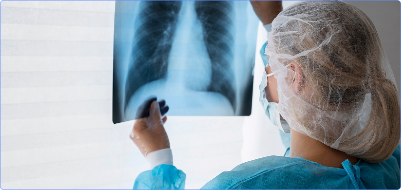 Chest X-Ray Reporting