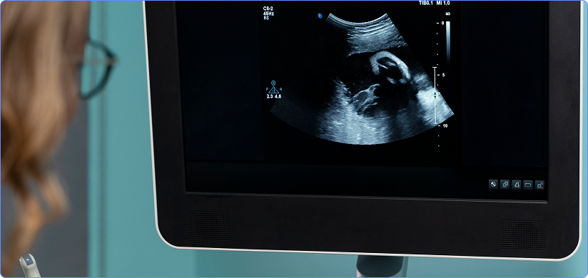 Ultrasound Reporting