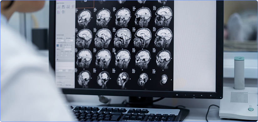Brain CT Scan Reporting