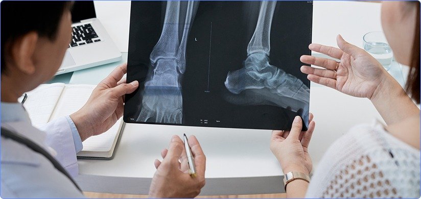 Lower Limbs X-Ray Reporting