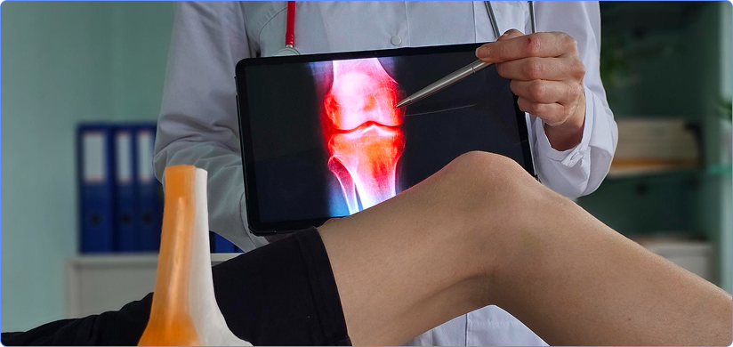 Knee X-ray Reporting