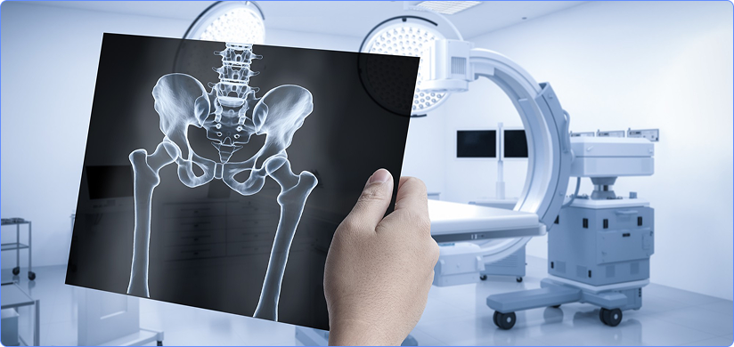 Hip X-ray  Reporting